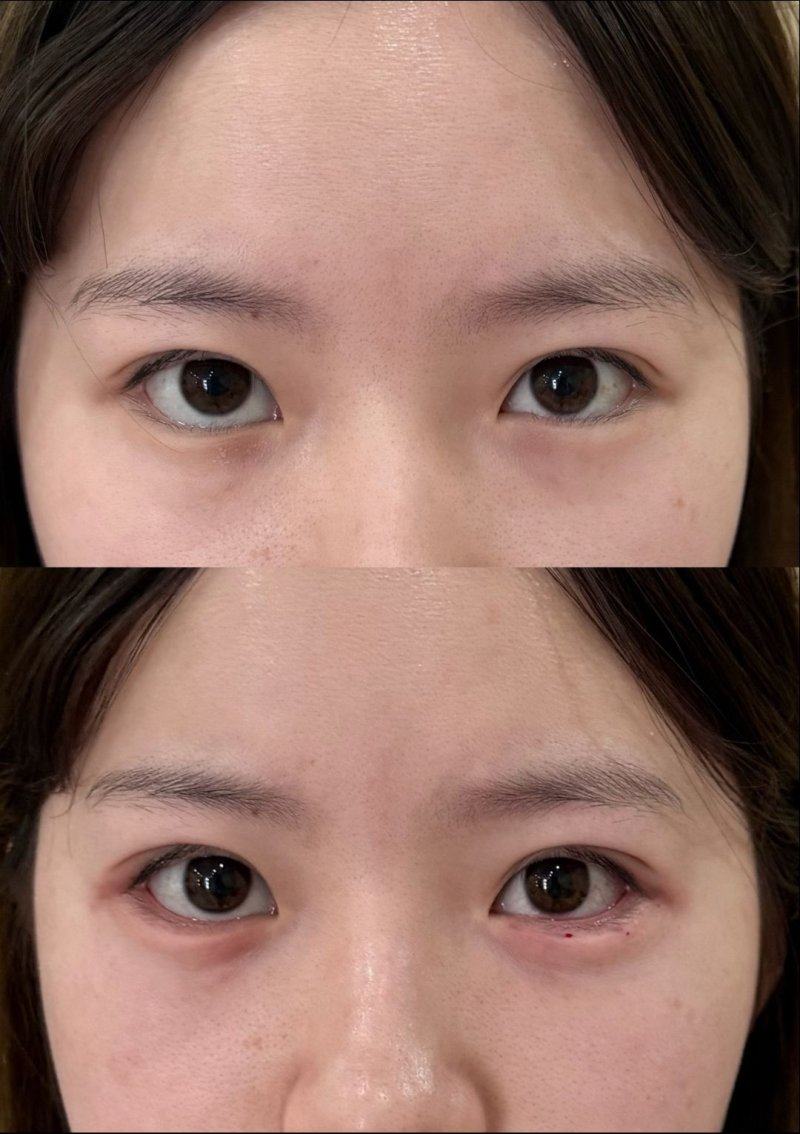 四、影响疤痕淡化速度的关键因素