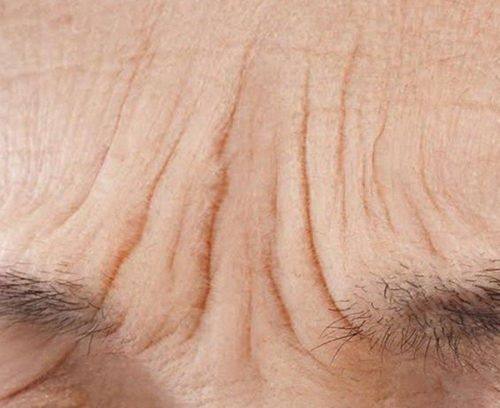 二、不同假体与容量的术后成效表现