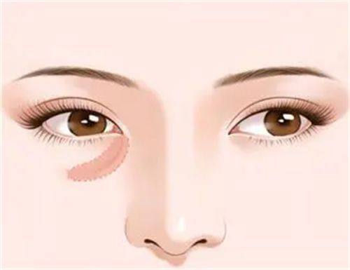 三、术后24-48小时:严格控制手机使用时长