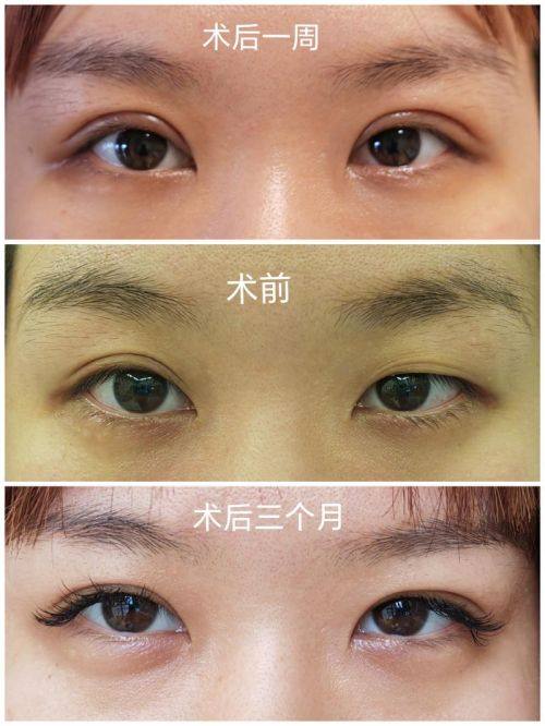 武汉美谛整形医院医生名单及擅长领域: