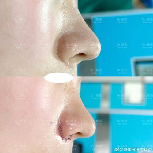 南宁脂美人医疗美容医院地址电话及营业时间：