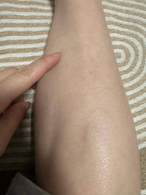 human皮肤科医院 龙山店口碑评价