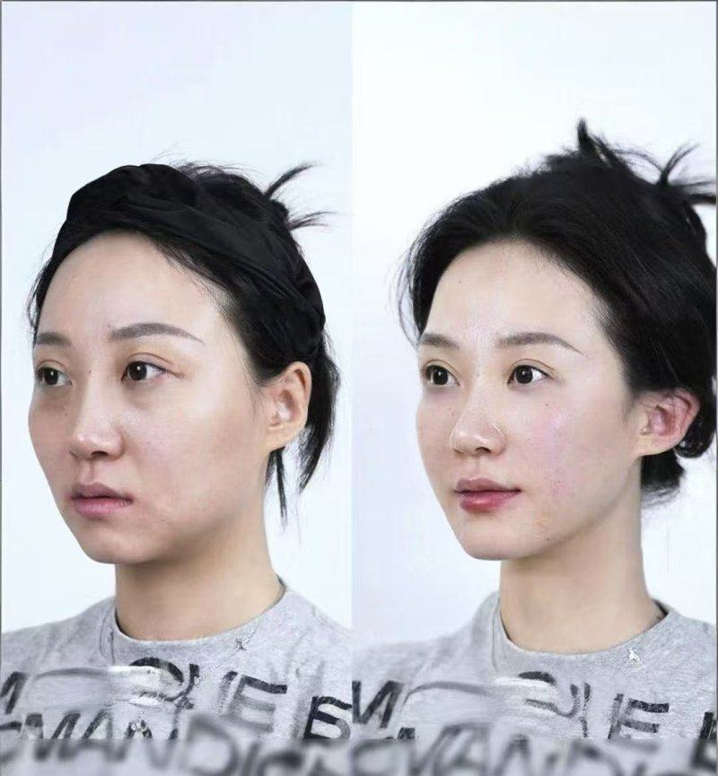 human皮肤科医院 龙山店怎么样