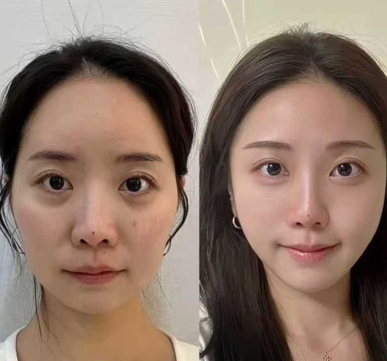 韩国拉本LaBom整形外科医院预约挂号方式: