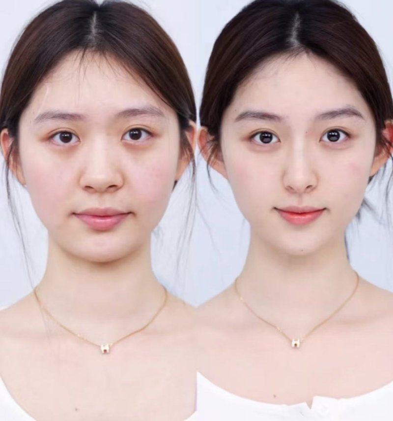 青岛铭医整形医疗美容医院口碑评价: