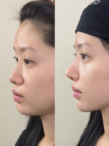 北京汇恩医疗美容诊所口碑评价