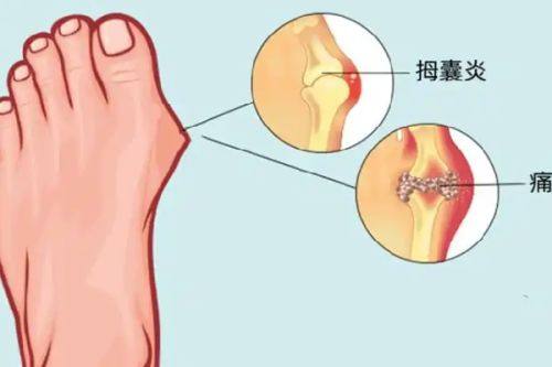 四、双眼皮手术到底有危害吗?