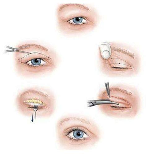 五、加速修复:科学护理要点全掌握