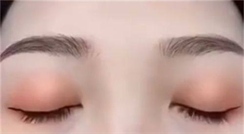 耳软骨搭配假体的持久成效分析