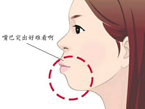 “整容”标签下的明星容貌困境