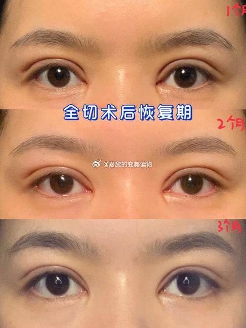 汪阳医生怎么预约