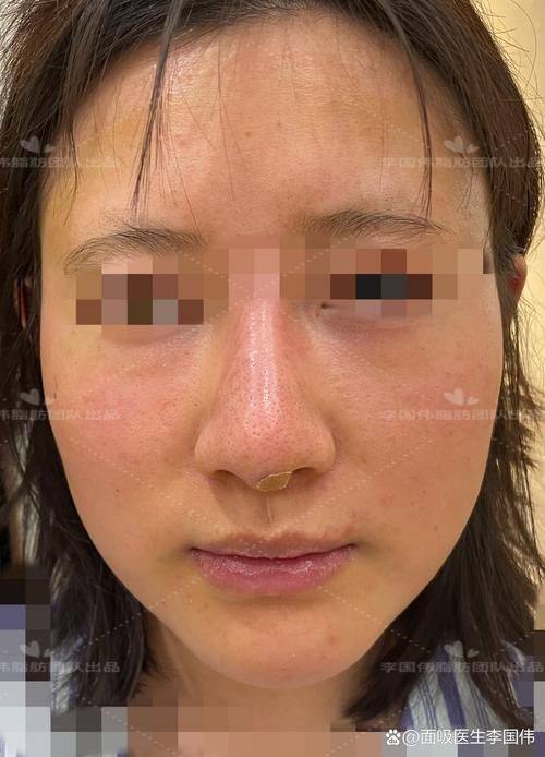 韩国IWANT整形外科预约挂号方式