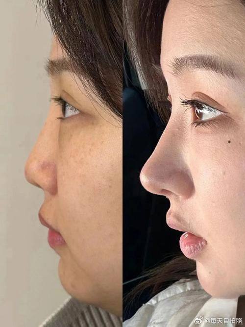 舟山依来美医疗美容诊所口碑评价