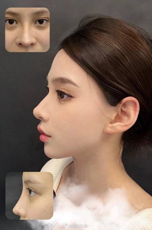 金华婺城溯美整形医院地址电话及营业时间：