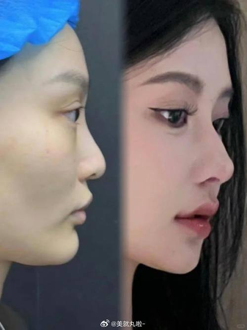 宁波鄞州花历整形医院怎么样?