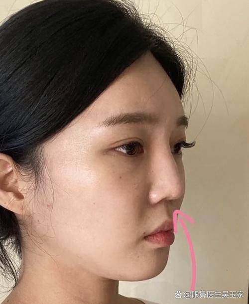 成都造美人医疗美容门诊部医生名单及擅长领域：