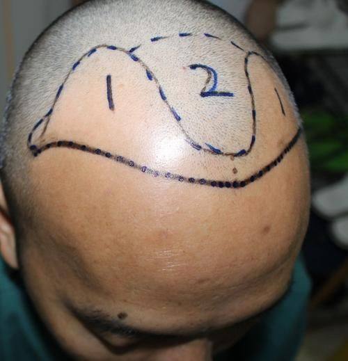 广州星耀医疗美容诊所价格表