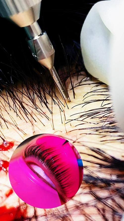 广州星耀医疗美容诊所地址电话及营业时间