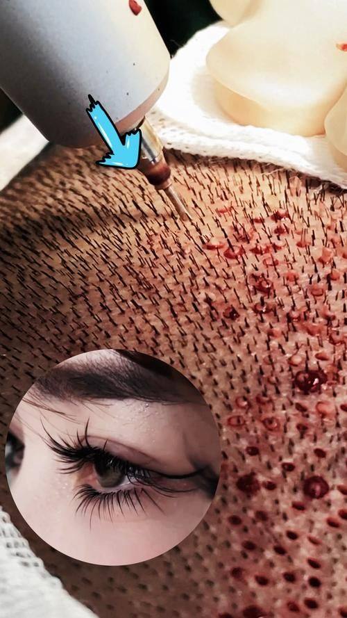 广州星耀医疗美容诊所擅长项目: