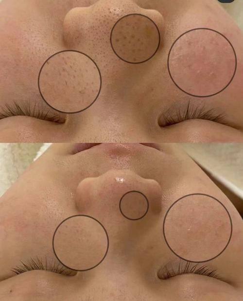 宁波鄞州菁漾整形医院价格表：