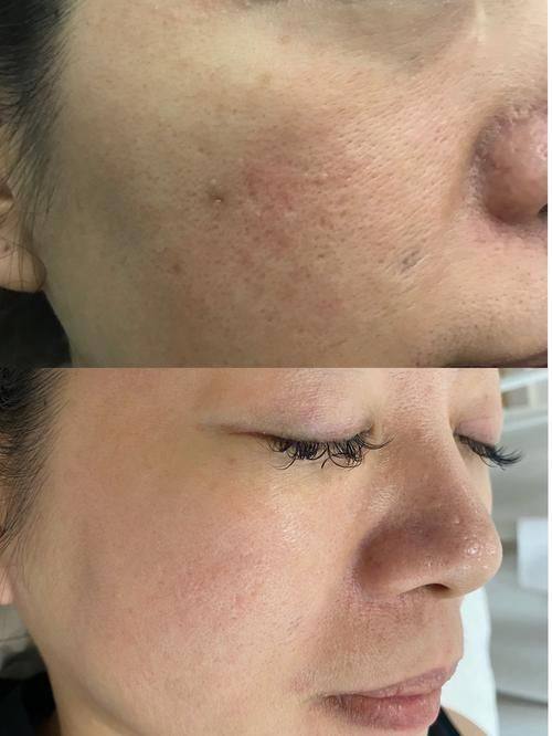 金华婺城溯美整形医院擅长项目：