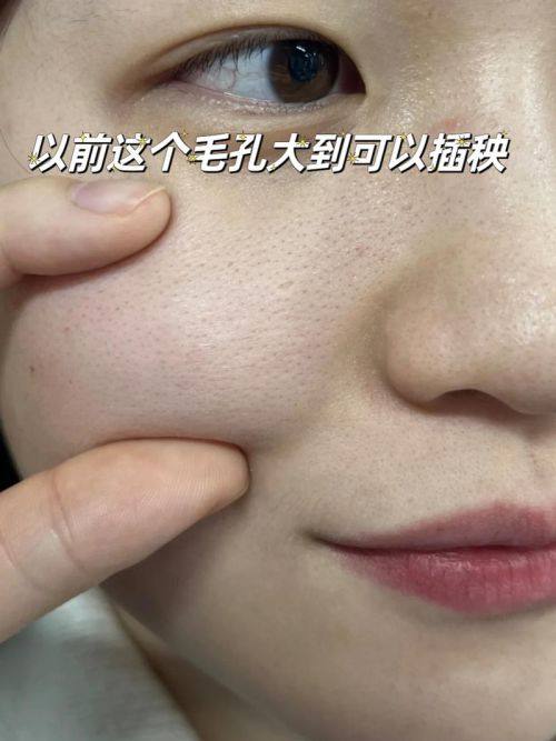 宁波鄞州菁漾整形医院擅长项目：