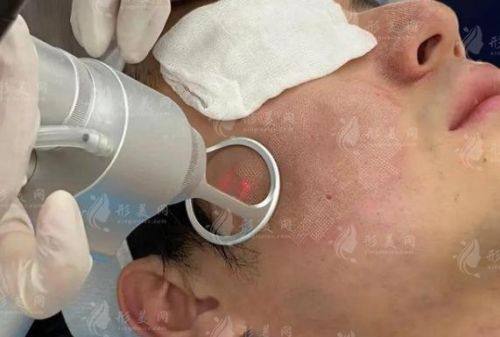 宁波鄞州花历整形医院医生名单及擅长领域: