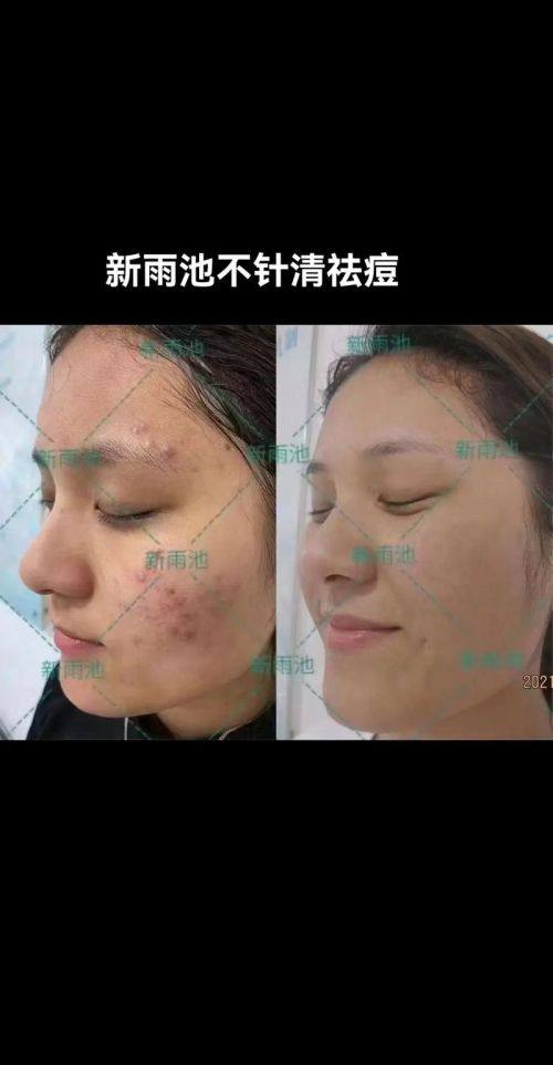 宁波鄞州菁漾整形医院医生名单及擅长领域：