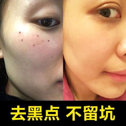 金华婺城溯美整形医院口碑评价：