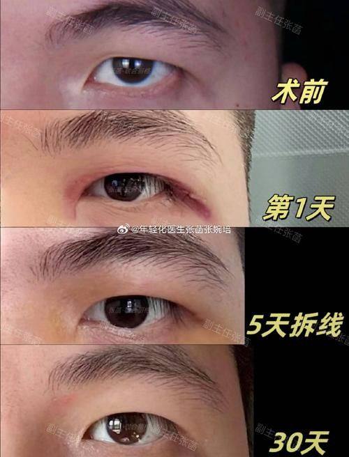 韩国IWANT整形外科擅长项目