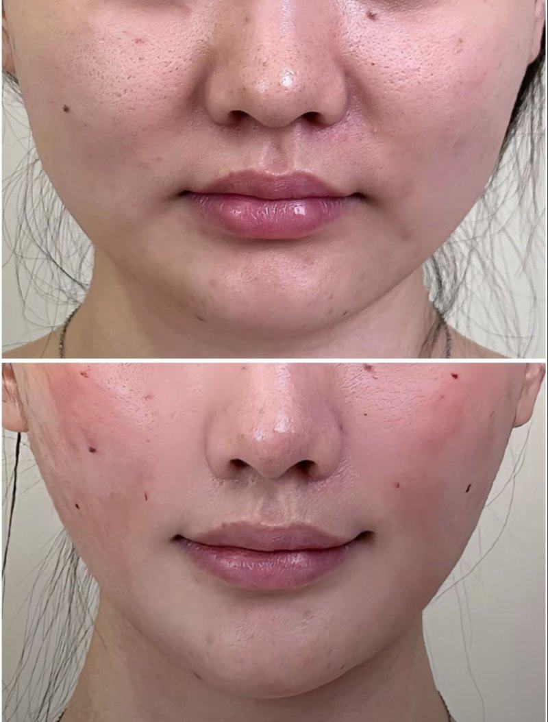 三、日常习惯调整,预防+长期改善眼袋浮肿