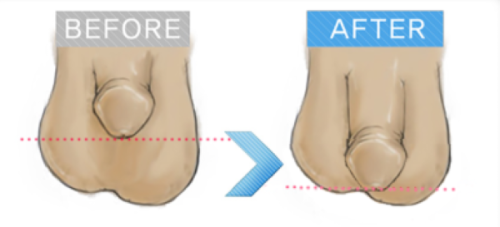 五、内双眼皮的认知误区：别再把它当成单眼皮