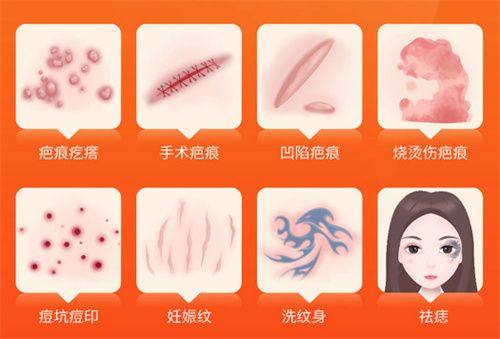 个性化定制：适配不同眼部基础的矫正方案