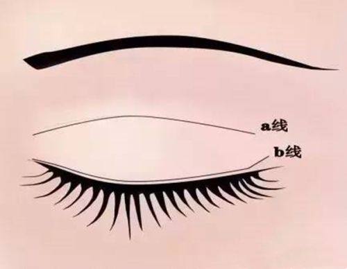 二、特殊兵种：疤痕要求“加码”，零容忍或更严标准