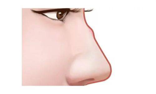 关于车厘子与术后疤痕的常见误区澄清