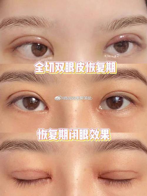 深圳园美整形医院价格表