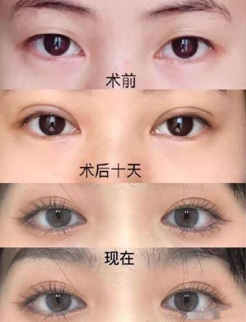 太原青松整形美容门诊部怎么样？