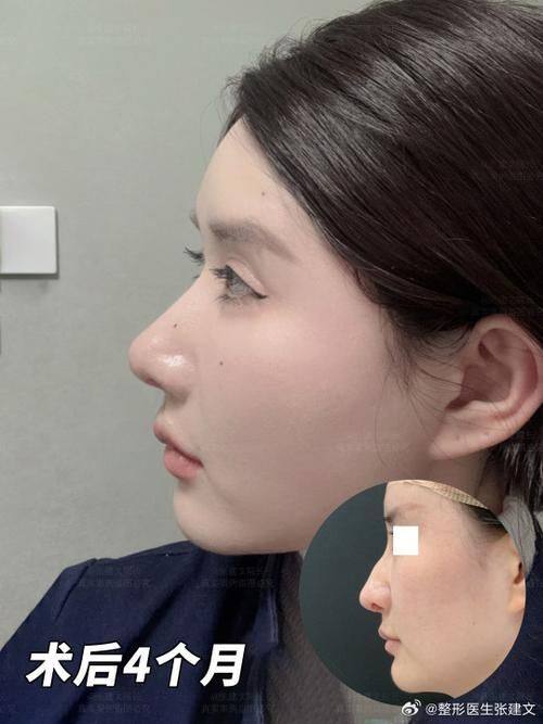 TCB 下关价格表: