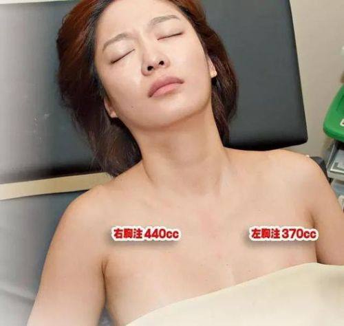 四川西婵泛亚医学美容医院预约挂号方式