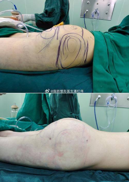 夏炜医生擅长领域