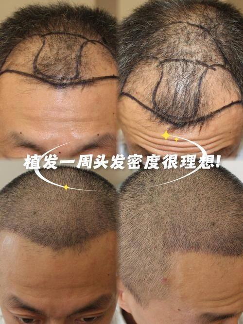 义乌新生医疗美容门诊部医生名单及擅长领域：