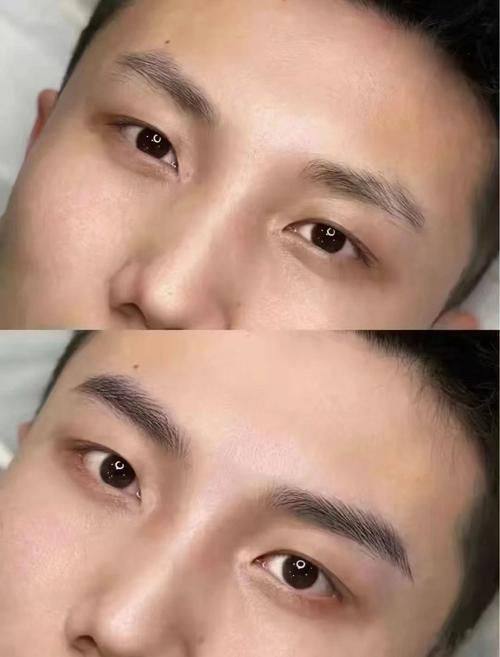 广州科发源植发中 心预约挂号方式：