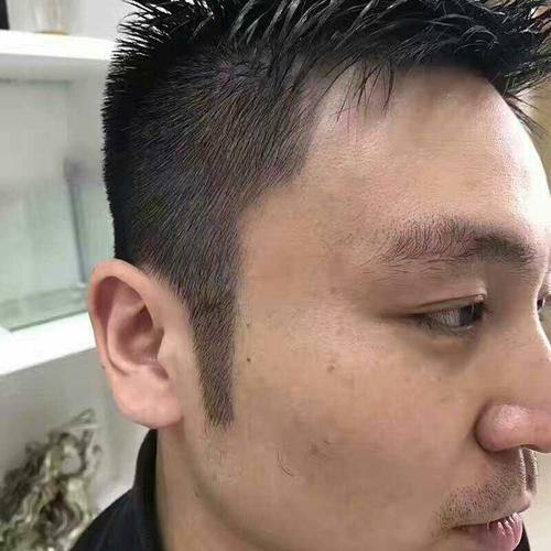 广州瑞丽诗植发医院怎么样?