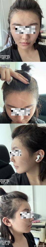 广州瑞丽诗植发医院地址电话及营业时间: