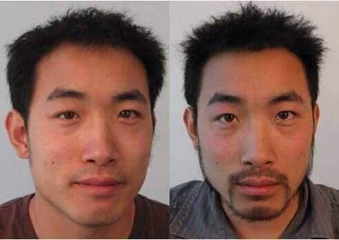 广州瑞丽诗植发医院医生名单及擅长领域: