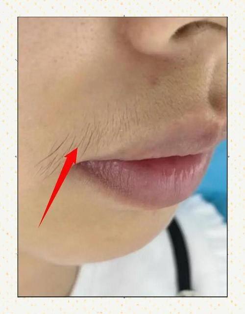 义乌新生医疗美容门诊部怎么样？