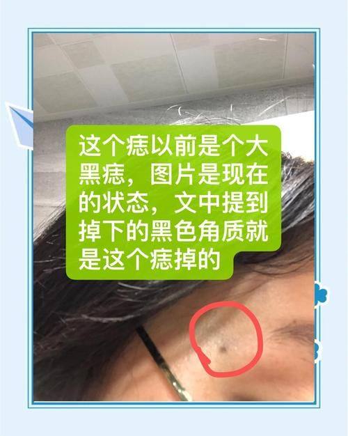 四川西婵泛亚医学美容医院医生名单及擅长领域：