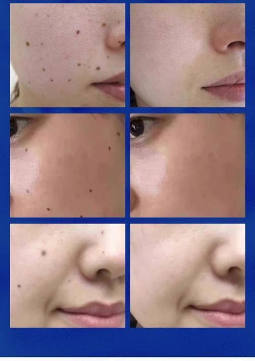 黑龙江阳光女子医院擅长项目