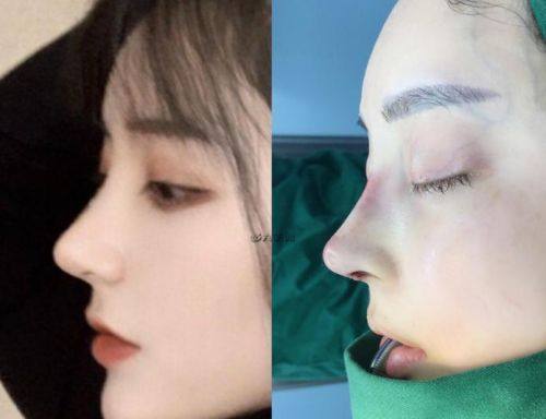 义乌新生医疗美容门诊部价格表：