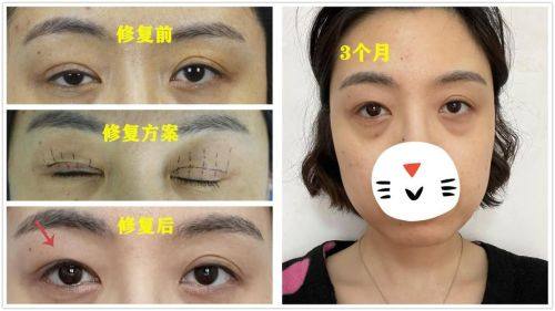 常州铂曼医疗美容门诊部医生名单及擅长领域：